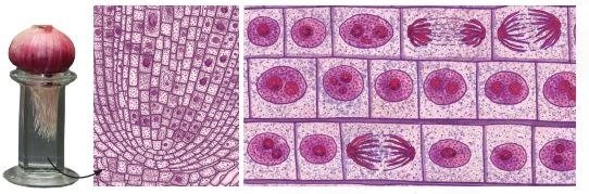 Different stages of cell division in onion root tip cells