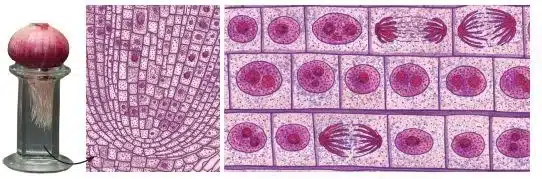 Different stages of cell division in onion root tip cells
